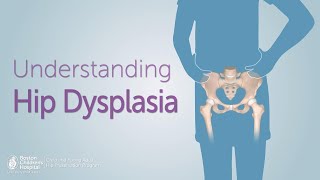 Dysplasia The Progression of Cancer [upl. by Firahs120]