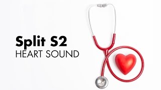 Fixed Split S2  Heart Sounds  MEDZCOOL [upl. by Aniehs]