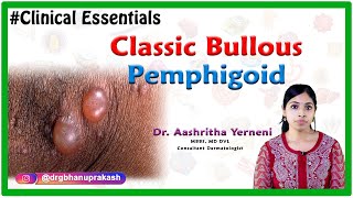 Classic bullous pemphigoid Clinical essentials Dr Aashritha yerneni [upl. by Dulci]