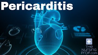 Cardiac Pericarditis [upl. by Baruch]