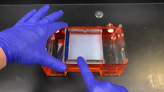 Agarose Gel Electrophoresis [upl. by Alig]