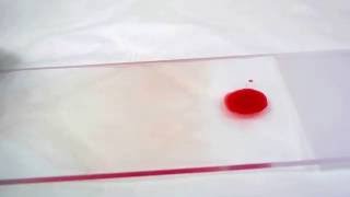 Geste technique  frottis sanguin  Blood smear [upl. by Verger]