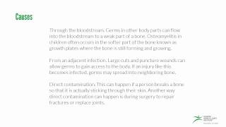 Radiographic Features of Osteomyelitis [upl. by Ambrogio435]