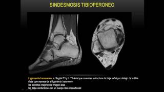 Anatomía de tobillo Resonancia M Parte 1 [upl. by Salvay327]