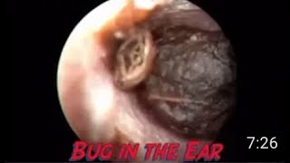 Decibullz Custom Molded Earplugs Instruction Video [upl. by Nettirb]