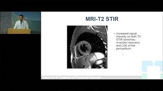 An Osmosis Video Congestive Heart Failure CHF Explained [upl. by Knarf891]