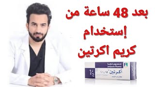 طريقة استخدام اكرتين لعلاج حب الشباب Acretin cream دكتور طلال المحيسن [upl. by Ymmij786]