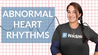 EKG like a BOSS Part 3  Abnormal Heart Rhythms [upl. by Anderea745]