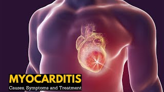 ECG Interpretation Practice  Pericarditis on EKG Explained [upl. by Ecila]