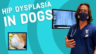 Boris Gait Assessment Hip Dysplasia [upl. by Haisi884]