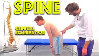 What’s Causing Your Low Back Pain [upl. by Perkin]