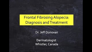 Frontal Fibrosing Alopecia FFA Diagnosis amp Treatment [upl. by Esma]