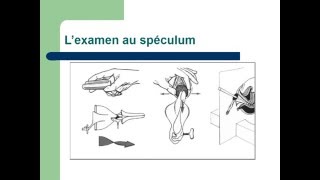 GYNECOLOGIE L’examen en gynécologie [upl. by Guss181]