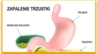 Jakie objawy wskazują na chorą trzustkę— 6 głównych objawów [upl. by Ives]