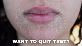 WATCH THIS BEFORE QUITTING RETINA  PURGING DRYNESS ACNE AND ANTIAGING [upl. by Vassili]